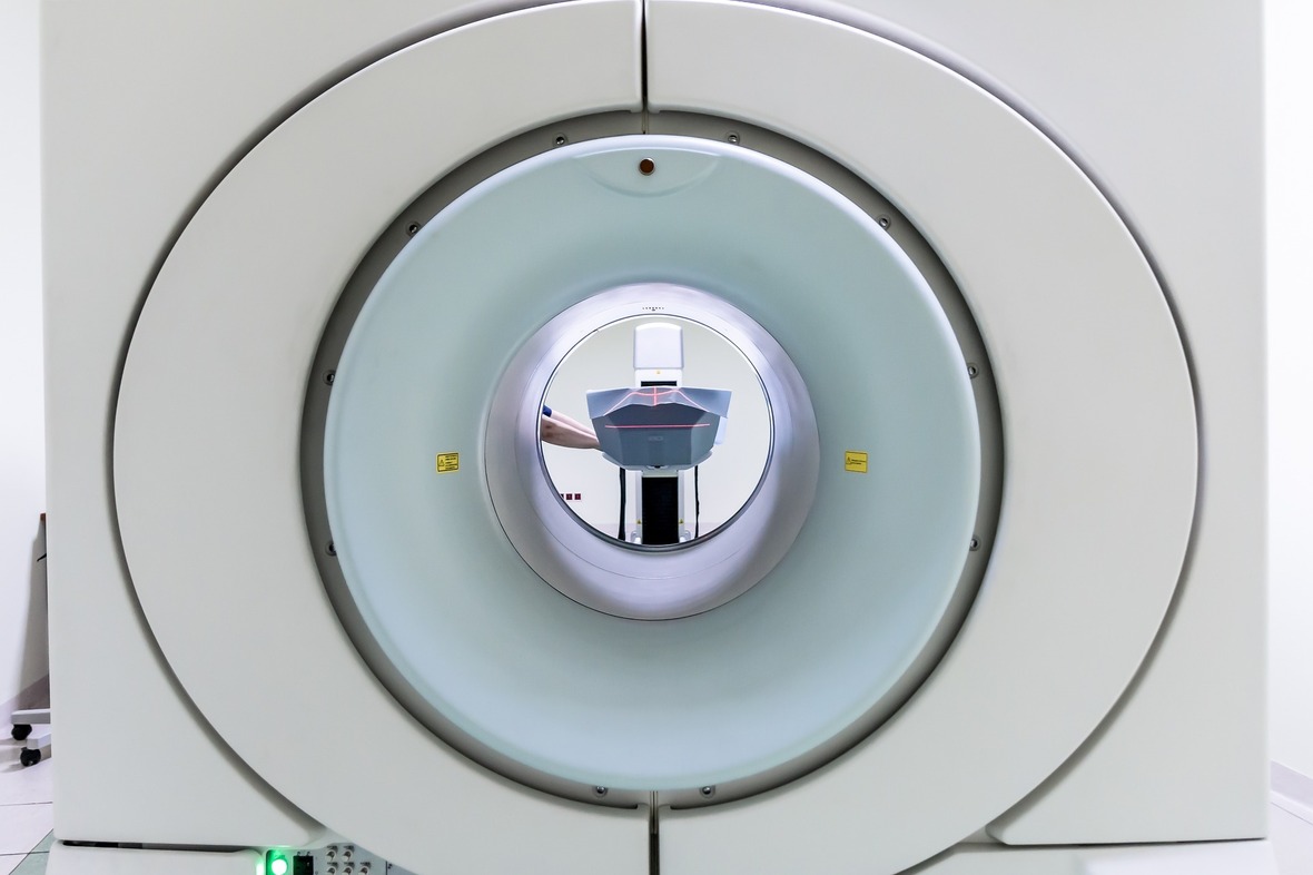 Opdracht: inwerktraject voor Radiotherapie bij het AVL